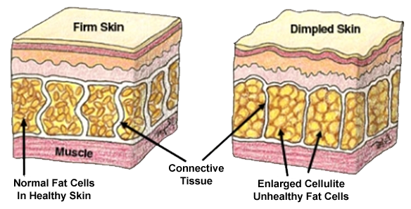skin_diagram